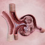 renal corpuscle